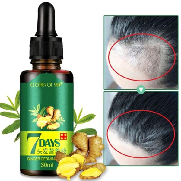 7 Days Fast Hair Growth Essence Oil Ginger Hair Growth Serum Nourishing Soften Treatment Hair Loss Repair Damaged Hair 10/30ML