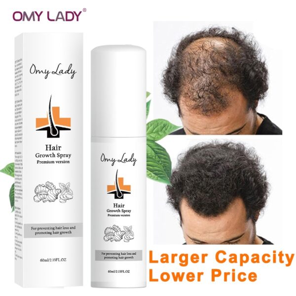 60ML OMYLADY Anti Hair Loss Hair Growth Spray Essential Oil Liquid For Men Women Dry Hair Regeneration Repair,Hair Loss Products