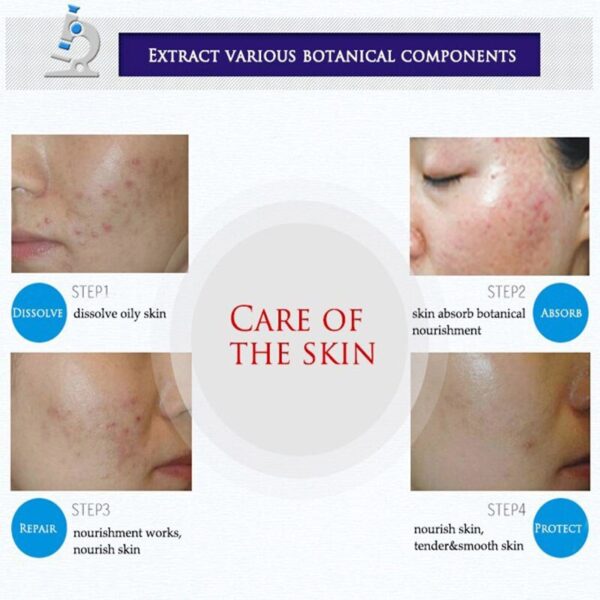BIOAQUA 3 kins/sets Face Care Repair Acne Scar Cream Acne Anti essence Skin Care deep clean Product