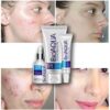 BIOAQUA 3 kins/sets Face Care Repair Acne Scar Cream Acne Anti essence Skin Care deep clean Product