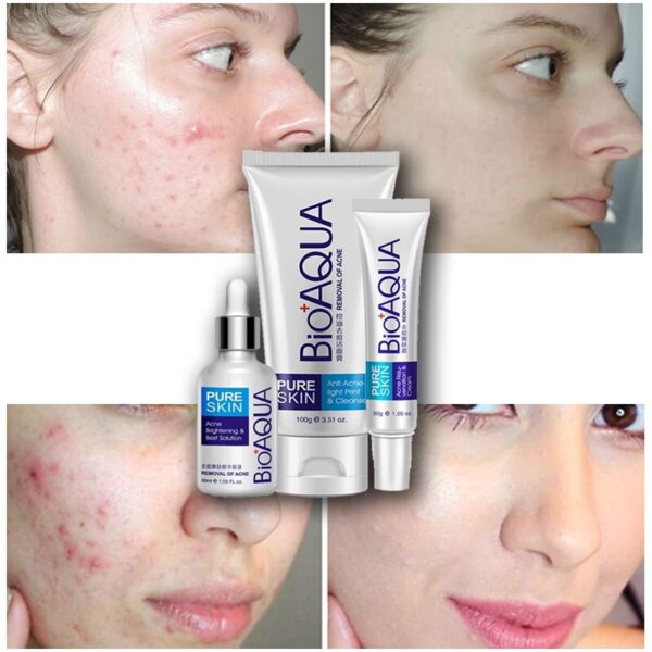 BIOAQUA 3 kins/sets Face Care Repair Acne Scar Cream Acne Anti essence Skin Care deep clean Product